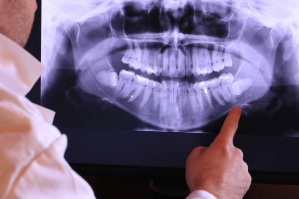 Best Emergency Broken Tooth Repair in Spring Lake Heights, NJ